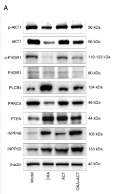 PLCB4 Antibody - Figure 9 - Effects of OXA + ACT on protein expression in the HepG2 model mice.