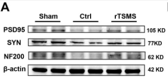 Synapsin I Antibody - Figure 3.
