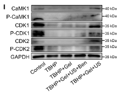 Phospho-CaMK1 alpha (Thr177) Antibody - Fig.