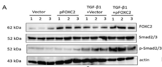 Smad2/3 Antibody - Figure 4 FOXC2 driving EMT changes in PMCs may be achieved through the TGF-β1-Smad2/3 signaling feedback loop.