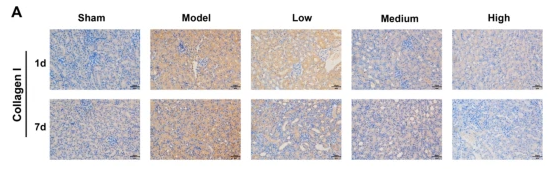 Collagen I Antibody - Fig.