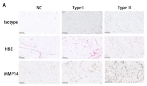 MMP14 Antibody - Figure 2.