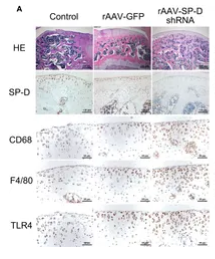 TLR4 Antibody - Figure 2 RAAV-mediated SP-D gene was transferred into the rat knee joints.