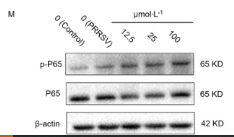 Phospho-NF-kB p65 (Ser536) Antibody - Figure 7.