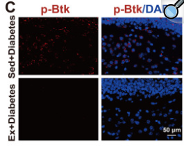 Phospho-BTK (Ser179) Antibody - Figure 7.