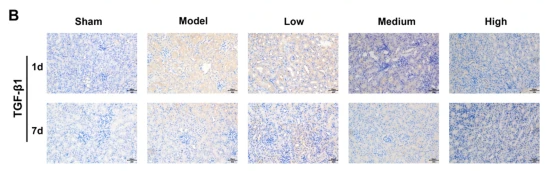 TGF beta 1 Antibody - Fig.