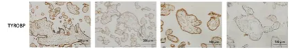 TYROBP Antibody - Figure 9.