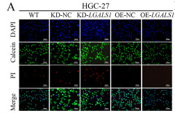 Galectin 1 Antibody - Fig.