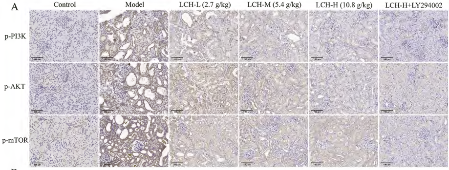 Phospho-AKT1/2/3 (Ser473) Antibody - Figure 5.
