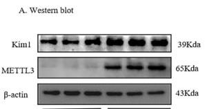 XAB2 Antibody - FIGURE 2 METTL3 inhibition alleviates uric acid-induced inflammatory and fibrotic response in vitro.