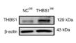 THBS1 Antibody - Figure 2.