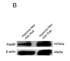 Transportin 1 Antibody - FIGURE 1 (A) The mRNA level of Kapβ2 in the hypoxic hippocampal neurons was detected by RT-qPCR after 48 h of adenovirus infection.
