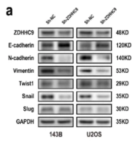 Twist1 Antibody - Fig.