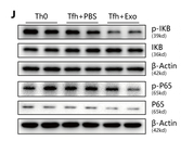 Phospho-NF-kB p65 (Ser536) Antibody - Fig.