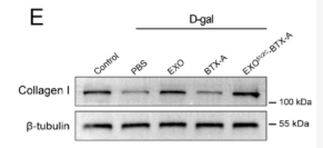 Collagen I Antibody - Figure 4.