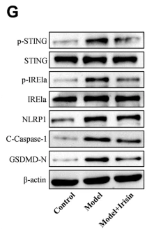 Phospho-TMEM173/STING (Ser366) Antibody - Fig.