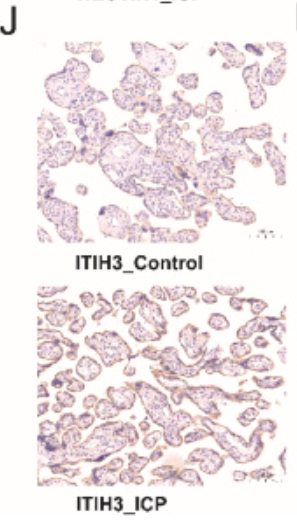 ITIH3 Antibody - Fig.