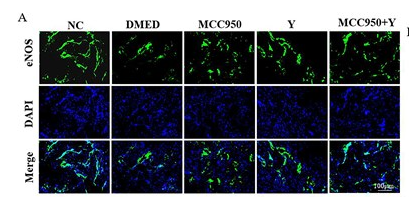 eNOS Antibody - Figure 7Yimusake intervention can ameliorate endothelial function.