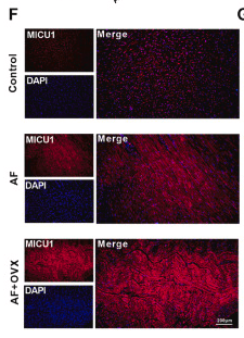 MICU1 Antibody - Fig.