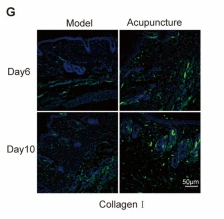 Collagen I Antibody - Fig.
