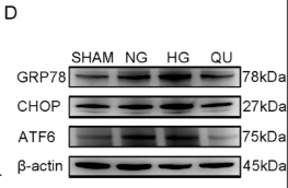 ATF6 Antibody - Fig 5.