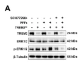 TREM2 Antibody - Fig.