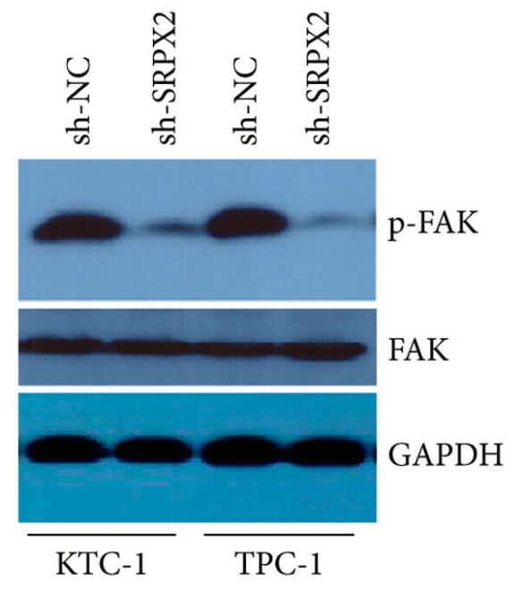 Phospho-FAK (Tyr397) Antibody - Figure 4.