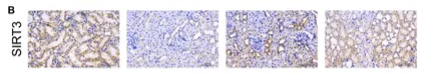 SIRT3 Antibody - FIGURE 6.