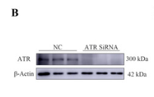 ATR Antibody - Figure 2.
