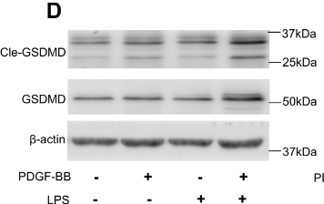 GSDMD Antibody - Figure 2.