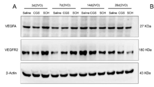 VEGFA Antibody - Fig.
