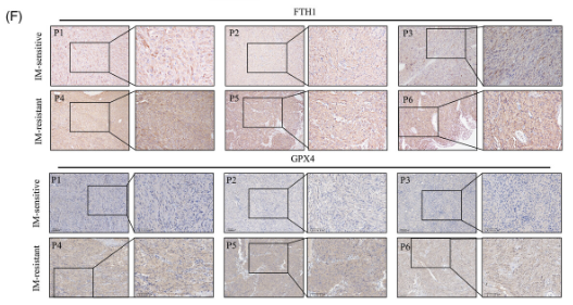 Ferritin Heavy Chain Antibody - FIGURE 1 Imatinib resistance is associated with ferroptosis activity in gastrointestinal stromal tumour (GIST).