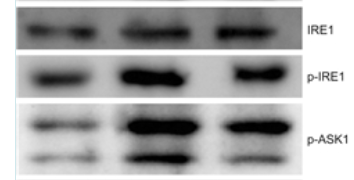 Phospho-IRE1 (Ser724) Antibody - 图 5 A7DG干预后HK-2细胞内Western blot表达趋势变化 A7DG干预后HK-2细胞中NADPH相关蛋白NOX4、NOX2和p22，氧化应激相关蛋白GRP78/BIP、IRE1、p-IRE1、p-ASK1、p38/MAPK、p-p38/MAPK和CHOP以及炎症相关因子IL-2、IL-6的Western blot表达和直方图的变化趋势，OX组与NC组比较，1)P＜0.