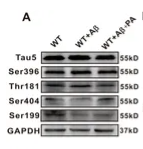 Phospho-Tau (Ser396) Antibody - Figure 7.