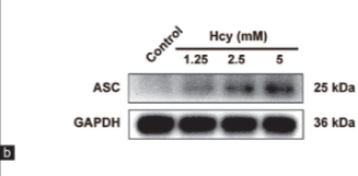 TMS1/ASC Antibody - Figure 3 Effects of homocysteine (Hcy) on nod-like receptor family protein 3 (NLRP3) inflammasome activation in HT22 cells.