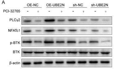 PLCG2 Antibody - Fig.