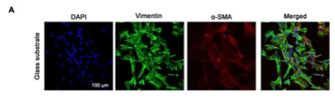 Vimentin mouse monoclonal Antibody - FIGURE 2.