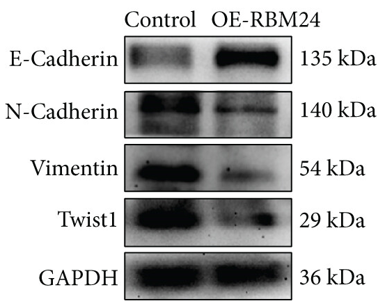 Twist1 Antibody - Figure 4.