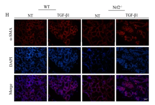 alpha-SMA Antibody - Fig.