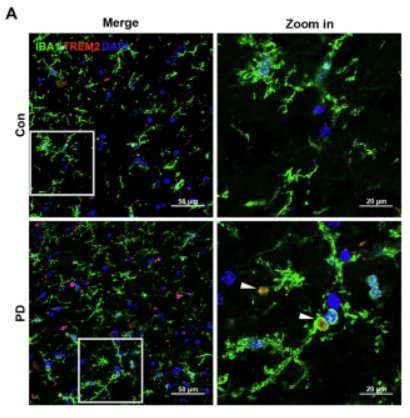 TREM2 Antibody - Fig.
