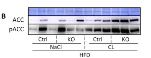 Phospho-ACC1 (Ser79)[Ser80] Antibody - Figure 4.