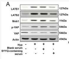 CXCL10 Antibody - FIGURE 6 SYYQ reverses the downregulation of miR-302a-3p and the activation of Hippo pathway in Hyp MCMECs.