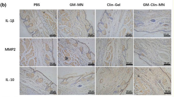 IL8 Antibody - FIGURE 6.