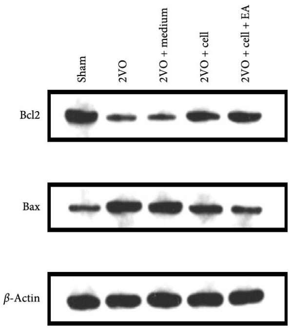 Bax Antibody - Figure 5 (A) The expressions of antiapoptotic protein Bcl2 and proapoptotic protein Bax were detected by western blot.