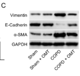 E-cadherin Antibody - FIGURE 2 OMT treatment ameliorates CS-induced pulmonary fibrosis and EMT in COPD mice.