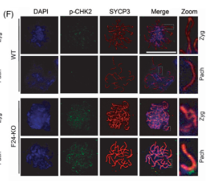 Phospho-Chk2 (Thr68) Antibody - FIGURE 7 Fbxw24 knockout increased RAD51 and p-CHK2 foci in female germ cells.