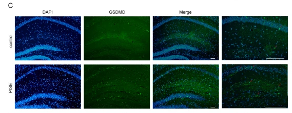 GSDMD Antibody - Fig.