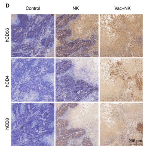 NCAM1 Antibody - Figure 6 The combined therapy mobilizes both T cell and NK cell immunity against EBV+ NPC in humanized mice (A) Quantification of the serum concentrations of human IFN-γ (left) and human TNF-α (right) in humanized mice from each group (ordinary one-way ANOVA with Tukey’s multiple comparisons test; ns, no significance; p > 0.