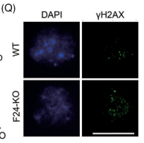 Phospho-Histone H2A.X (Ser139)[Ser140] Antibody - FIGURE 1 Oocyte-predominant FBXW24 is essential for female fertility.