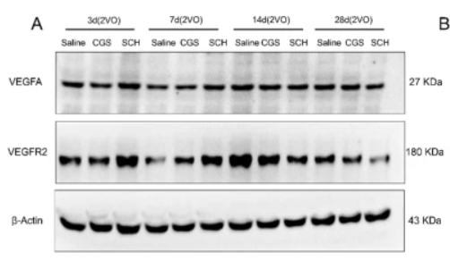 VEGFR2 Antibody - Fig.